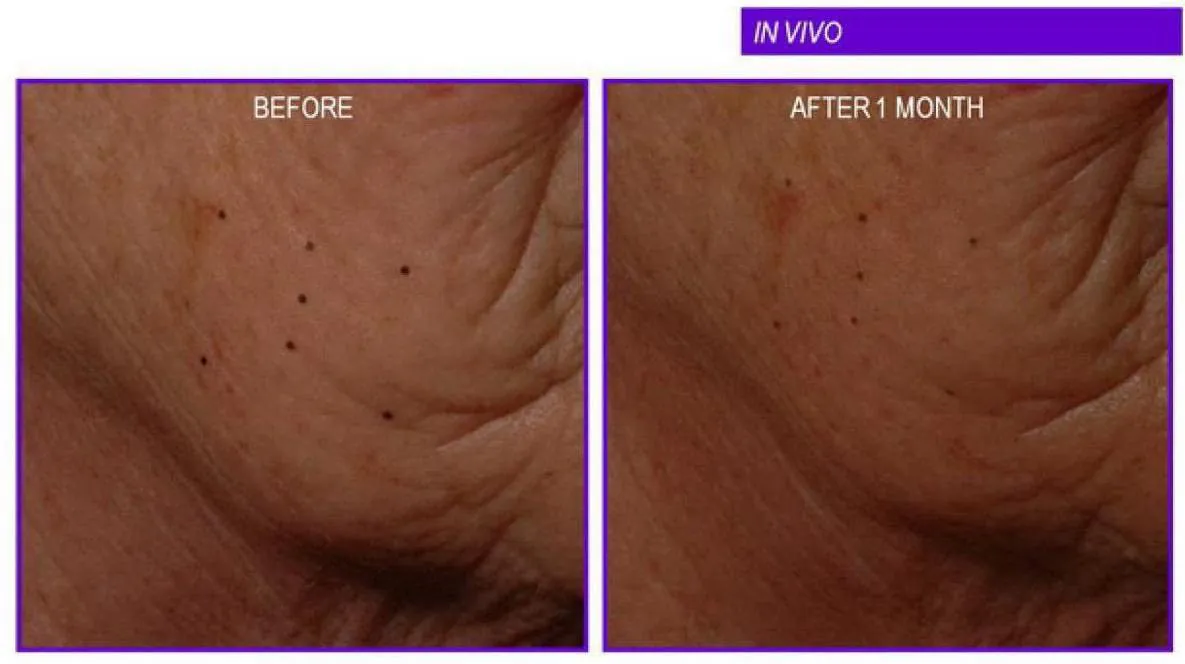 Retinol Anti-Age Complex