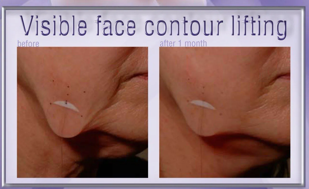 Retinol Anti-Age Complex
