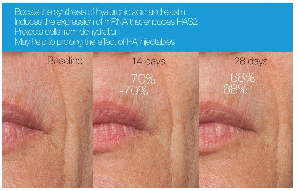 Retinol Anti-Age Complex