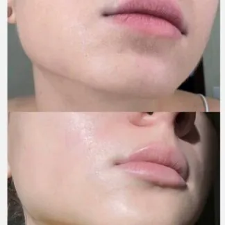 Крем для підтримки мікробіому PROBIOTIC CREAM