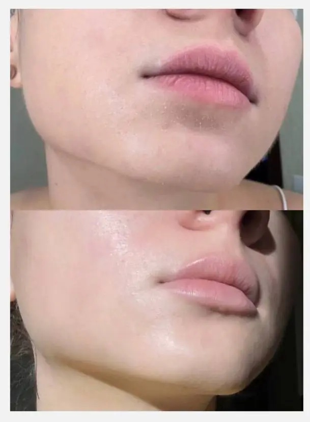 Крем для підтримки мікробіому PROBIOTIC CREAM - Зображення 2