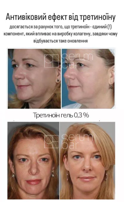 Набір TRE THERAPY з потужним ретинолом - Зображення 2