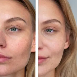 Cироватка з вітаміном С та феруловою кислотою C-BRIGHT SERUM